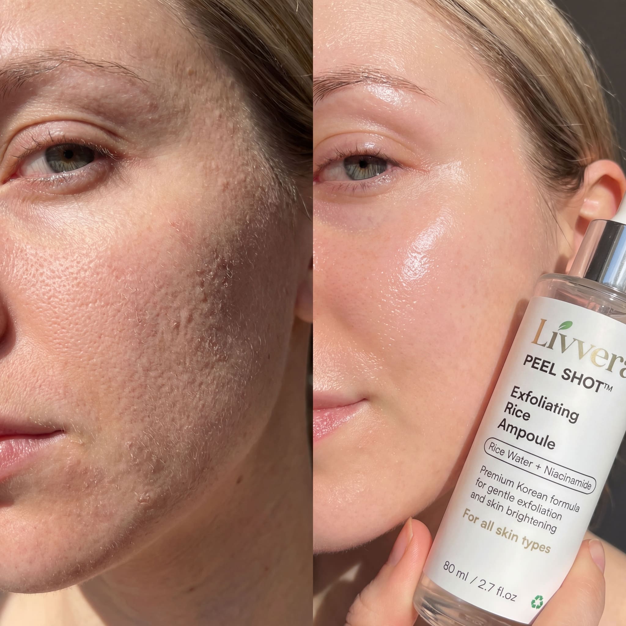 Before and after comparison of a woman's face with a product labeled 'Livera' held by a hand.